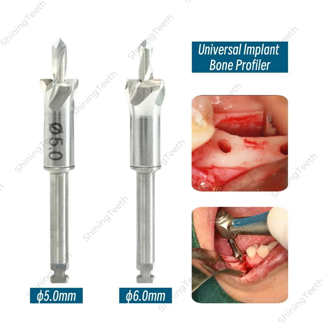 

Стоматологический имплантат, костный профилер, универсальная дрель для имплантата, шлифовальный бор с пилотным алвлярным триммером для хейбона, костная мельница, хирургический набор