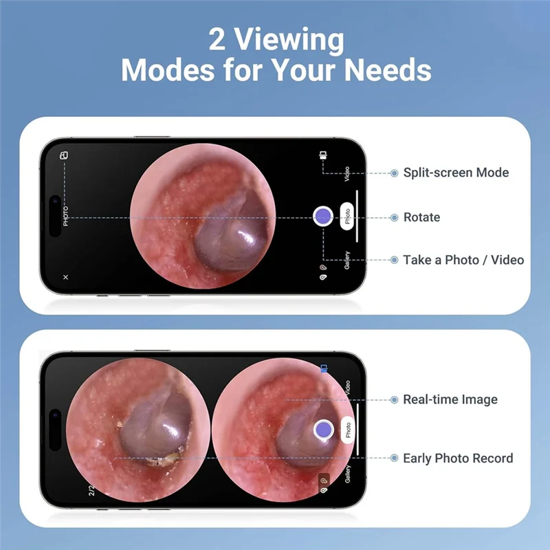 AA08-Digital Otoscope With 1.85In IPS Screen, Otoscope With Light, 720P HD Ear Wax Removal Tool Camera, Video Ear Camera