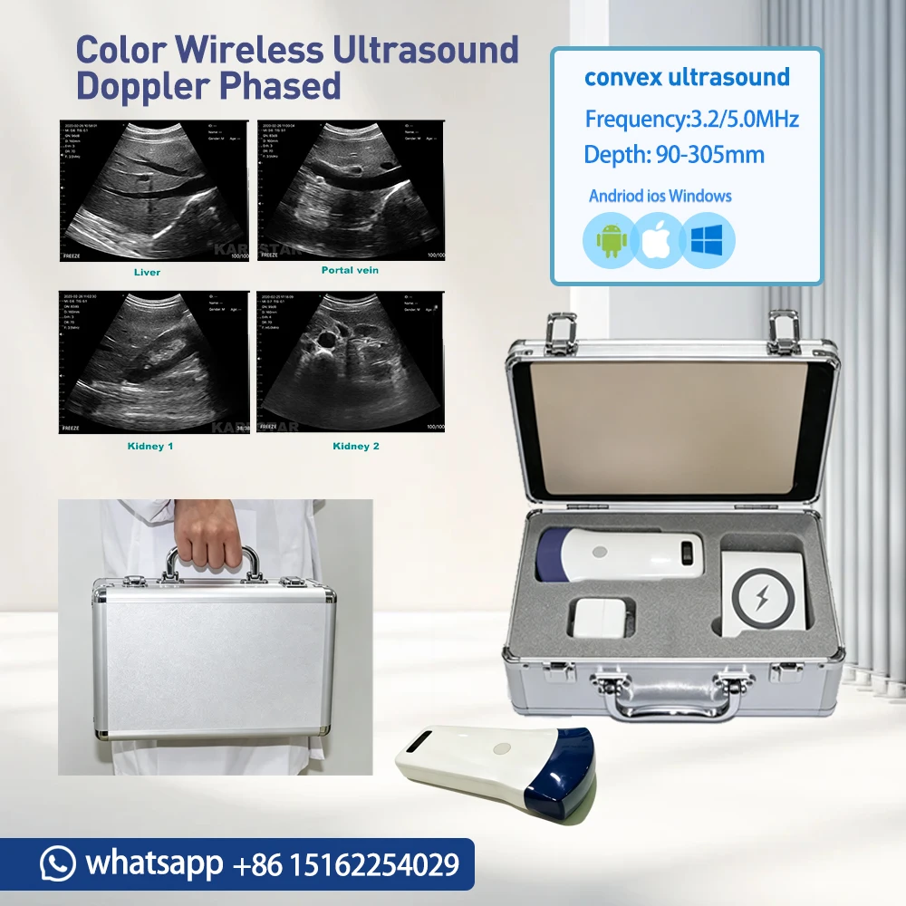 Mobile & PC Supported Convex Color Doppler Ultrasound Scanner WIFI Wireless 32 Channel animal Detector