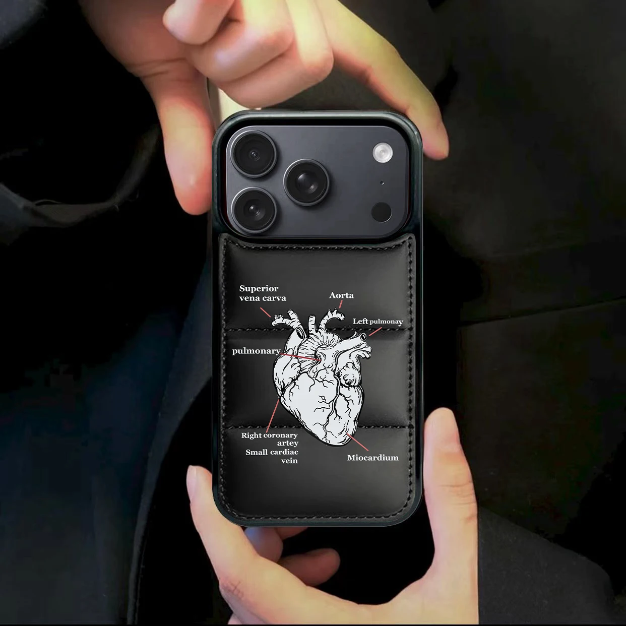 Luxury Heart Vessel… - image