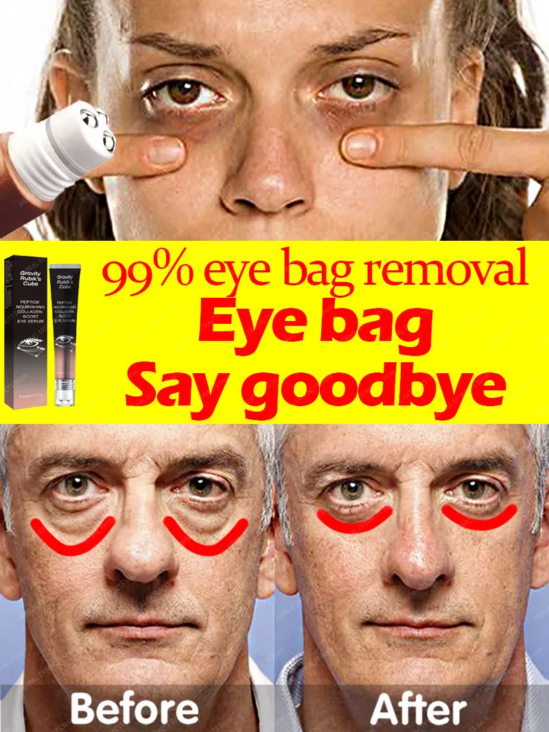 

Eye Cream For Bags Under The Eyes Fat Remove Anti Puffiness Care