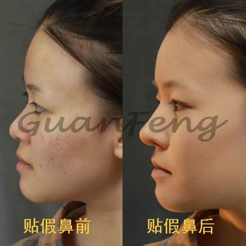 1 PCS False Nose, Disposable Soluble Edge COS Platinum Silicone Nose
