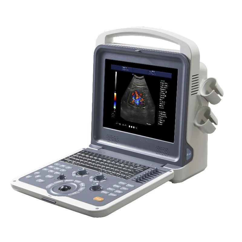 Medical 4D Human Vet Portable Color Doppler Ultrasound System Hospital Ultrasound Scanner