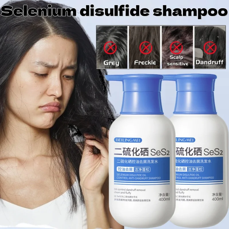 

Шампунь с дисульфидом селена 400 мл: Объем, контроль жирности, глубокое очищение, устранение зуда, смягчение кожи головы