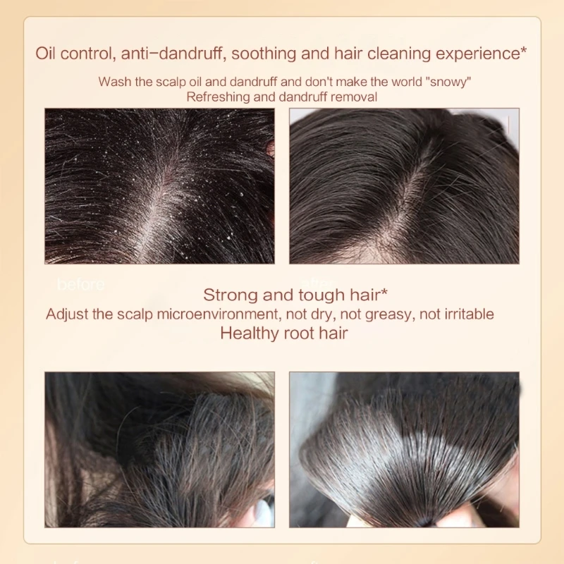 300ml Gengibre Cabelo Shampoo Hidratante Refrescante Shampoo Suavizante Nutritivo