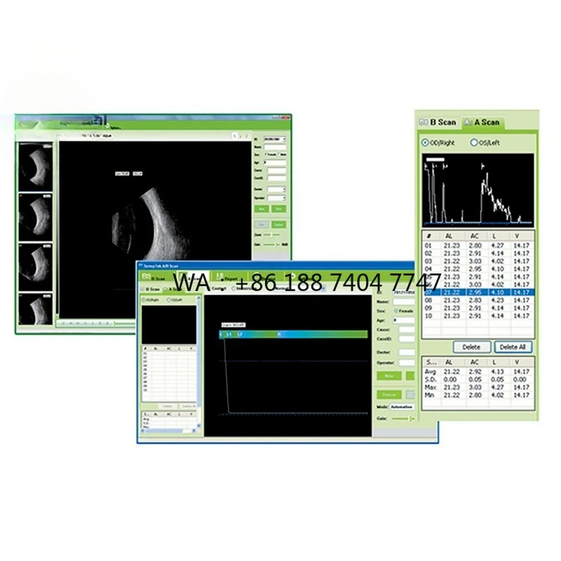 Escáner Oftálmico A/B SAB-200 de Alta Resolución para Diagnóstico de Enfermedades Intraoculares, Biómetro de Ultrasonido Oftálmico