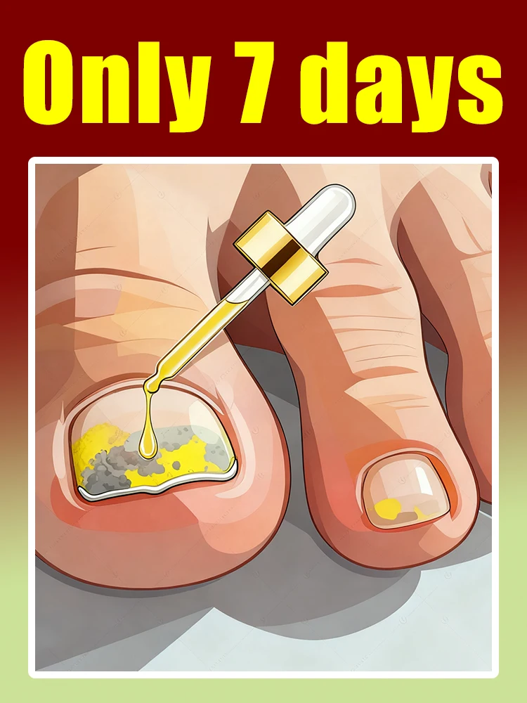 Fast penetration, nails become translucent and fungal free.