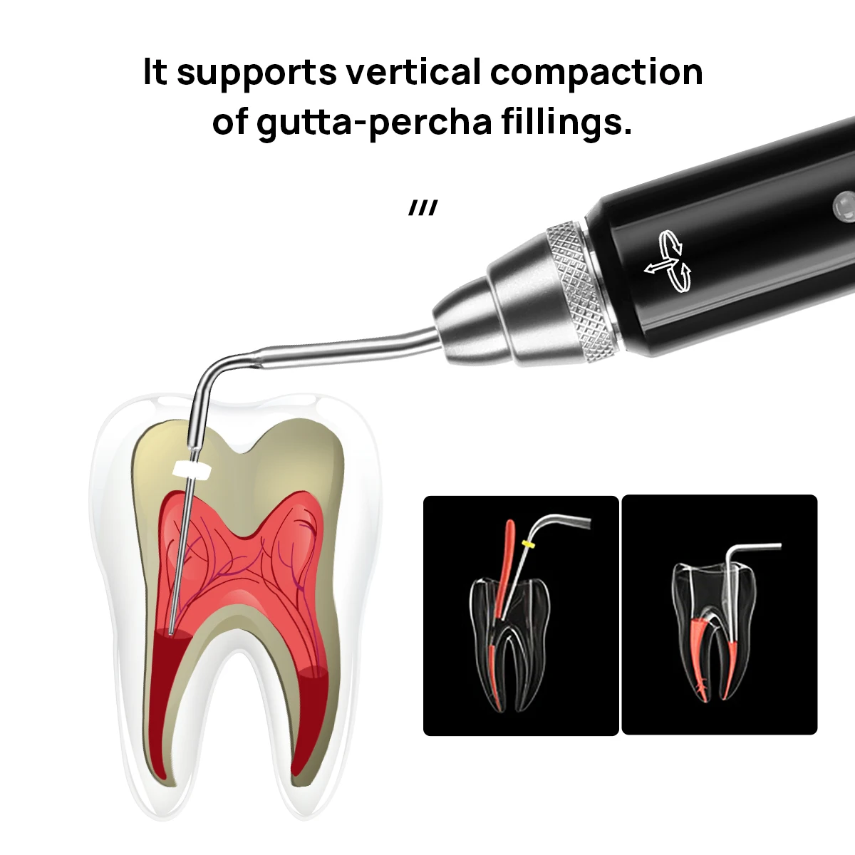 AZDENT-Sistema de obturación de gutapercha Dental inalámbrico, pluma calentada Endo, 2 puntas, laboratorio, 3 segundos, calentamiento rápido,