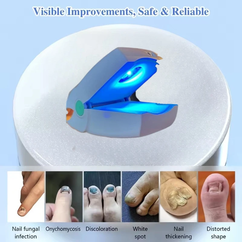 

Лазер медицинского класса 905 нм эффективное лечение грибка ногтей без боли или лекарств