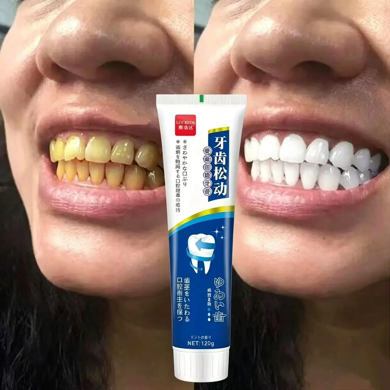 Fix Loose Teeth Japanese Imported Toothpaste for Yearround Oral Health for Adults Unisex Whitening Oral Care Brightening