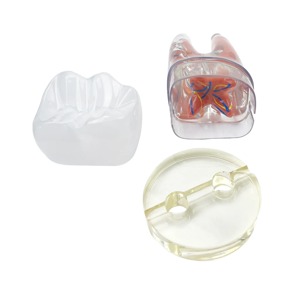 10 Times Endodontic Dental Model Large Clear Tooth Pulp And Nerve Teeth Model Detachable Models For Teaching Studying Education