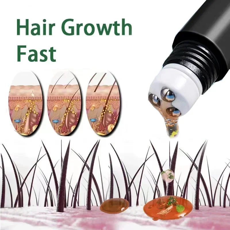 Biotin Hair Growth oil Products Care Scalp Massage Treatments Anti Hair Loss Effective Grow Thicker Hair serum