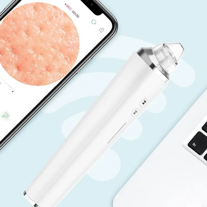 مزيل الرؤوس السوداء لتنظيف المسام متعدد السرعات من D0UE للوجه مع تحكم ذكي بالشفط ونصائح قابلة لإعادة الاستخدام #2