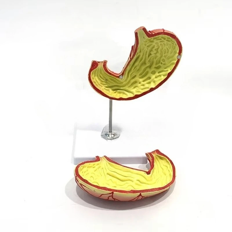 School teaching explanation Human stomach anatomical structure model 1.5x large removable