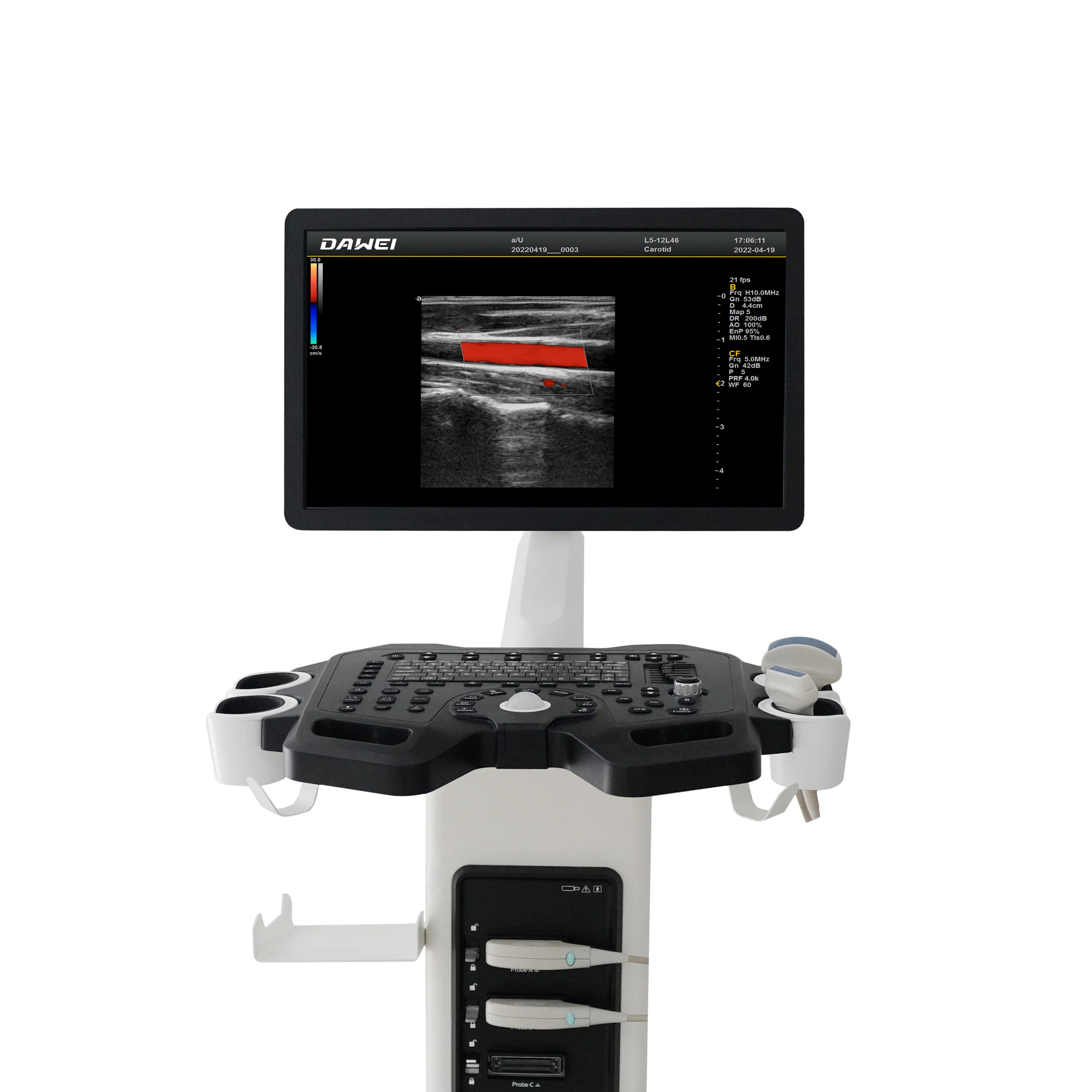 ultrasound scanner hospital trolley ultrasound ful