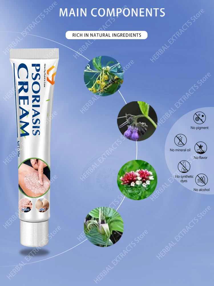 psoriasis ointment cream