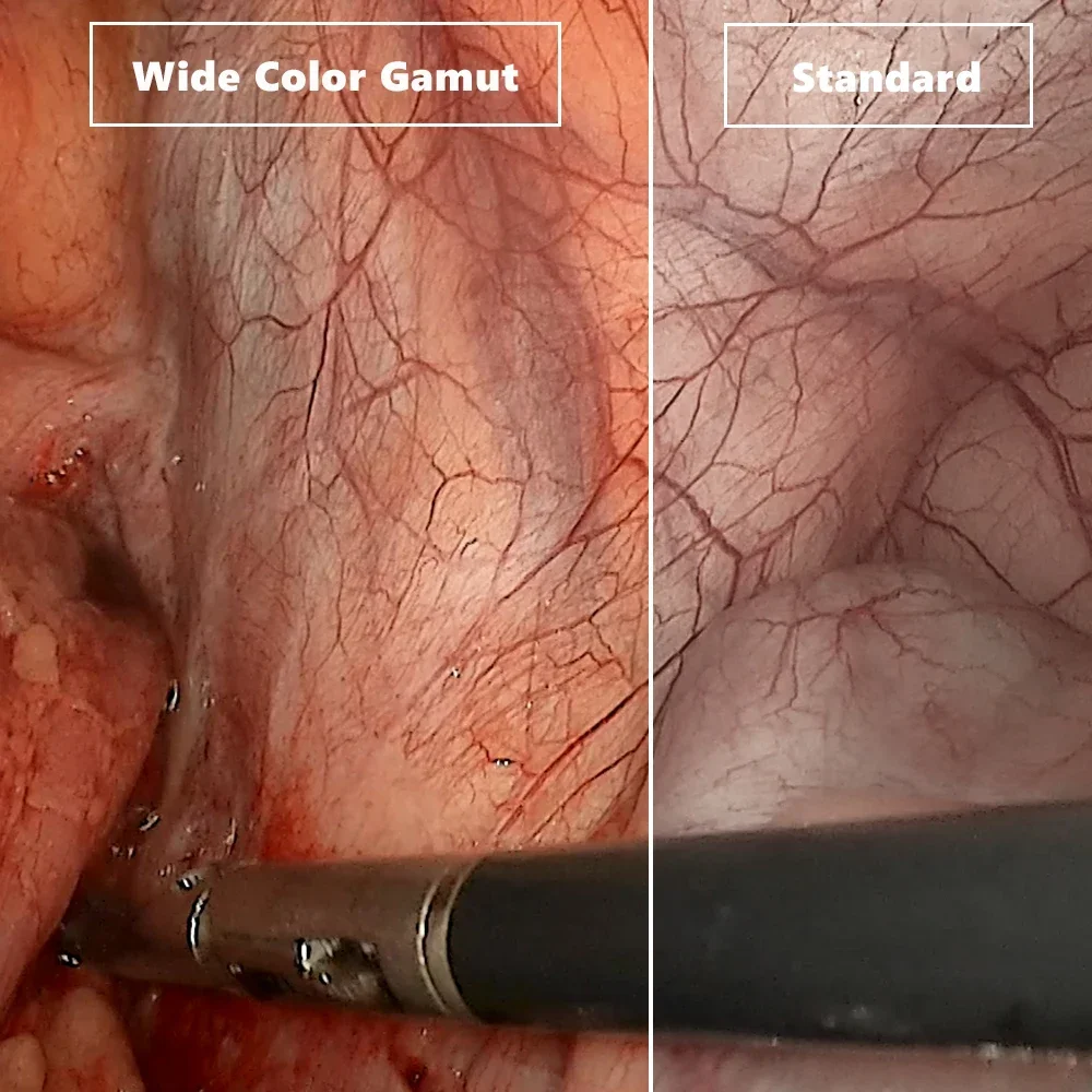 Laryngoscope/nutritionnel/Endoscopie par ventilateurs avec rotation à 360 °, prend en charge iOS et Android dip sive biByrforceps