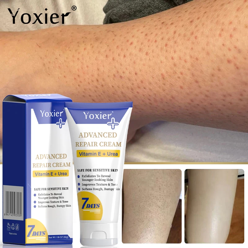 Repair Cream Vitamin E Moisturizing Improve Dry Rough Skin Remove Hard Lumps Exfoliate Smooth Soft Skin Care 1pc/3pcs/5pcs/10pcs