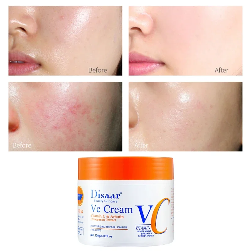 Vitamin C Whitening Freckles Face Cream Remove Melasma Dark Spots Lighten Melanin Anti-Aging Brighten Korean Skin Care 120g