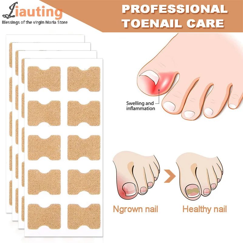 Ingrown Correção de Unhas Adesivos, Unha Corretor Patches, Tratamento Paroníquia, Recuperar, Ferramenta Pedicure Care, 60Pcs