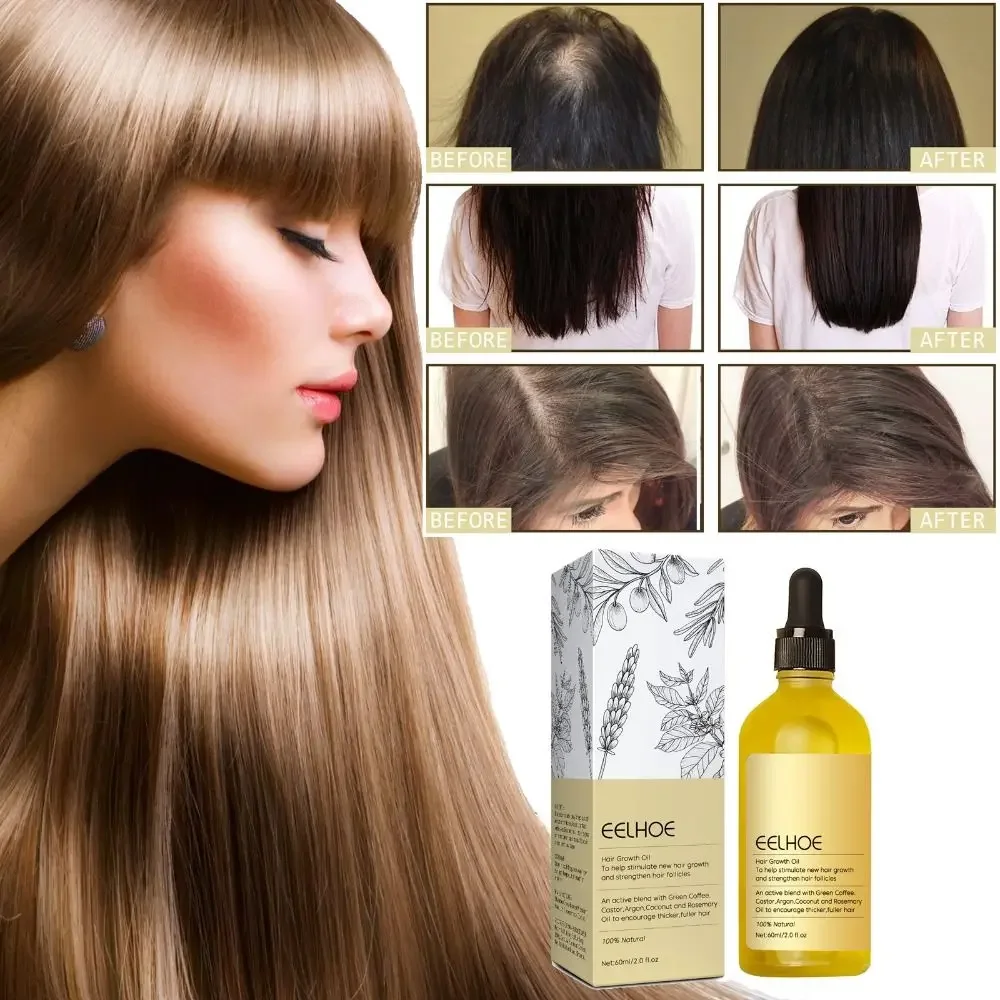 Aceite Natural para el crecimiento eficiente del cabello, Aceite hidratante suave para la pérdida de cabello, reparación del cabello dañado, aceite esencial nutritivo, nuevo