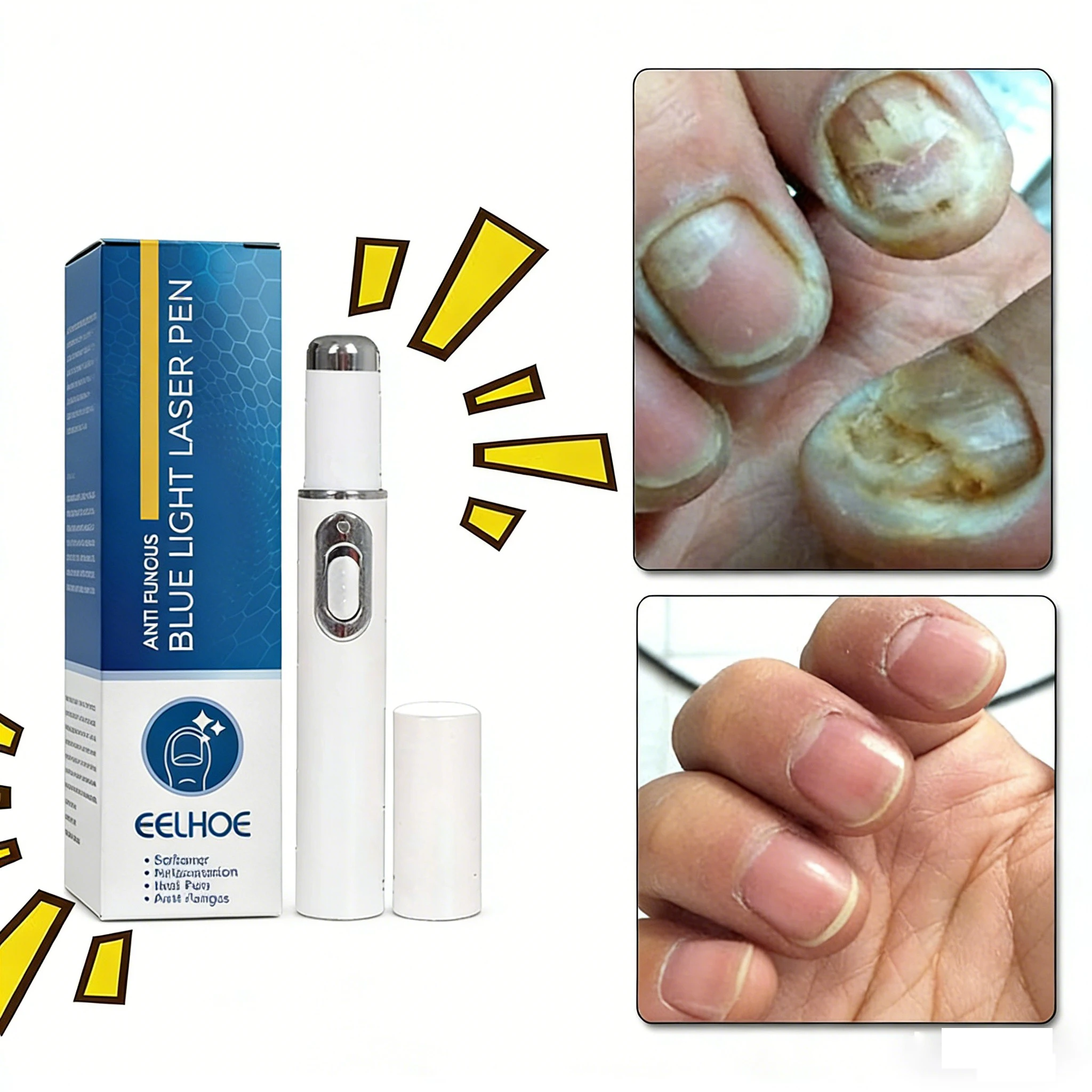 

The new generation of champagne-colored nail laser pen helps you say goodbye to single-sided nail art and can thoroughly clean.