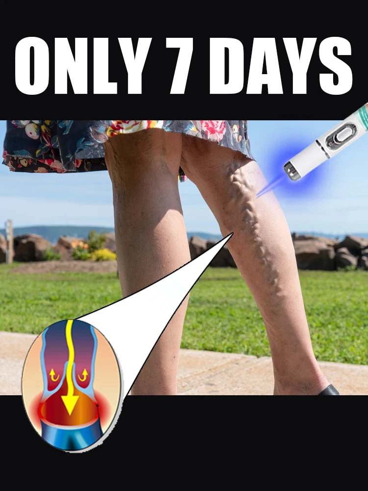 

Vein blue light tool, more discounts on sets Leg care tools say goodbye to varicose veins