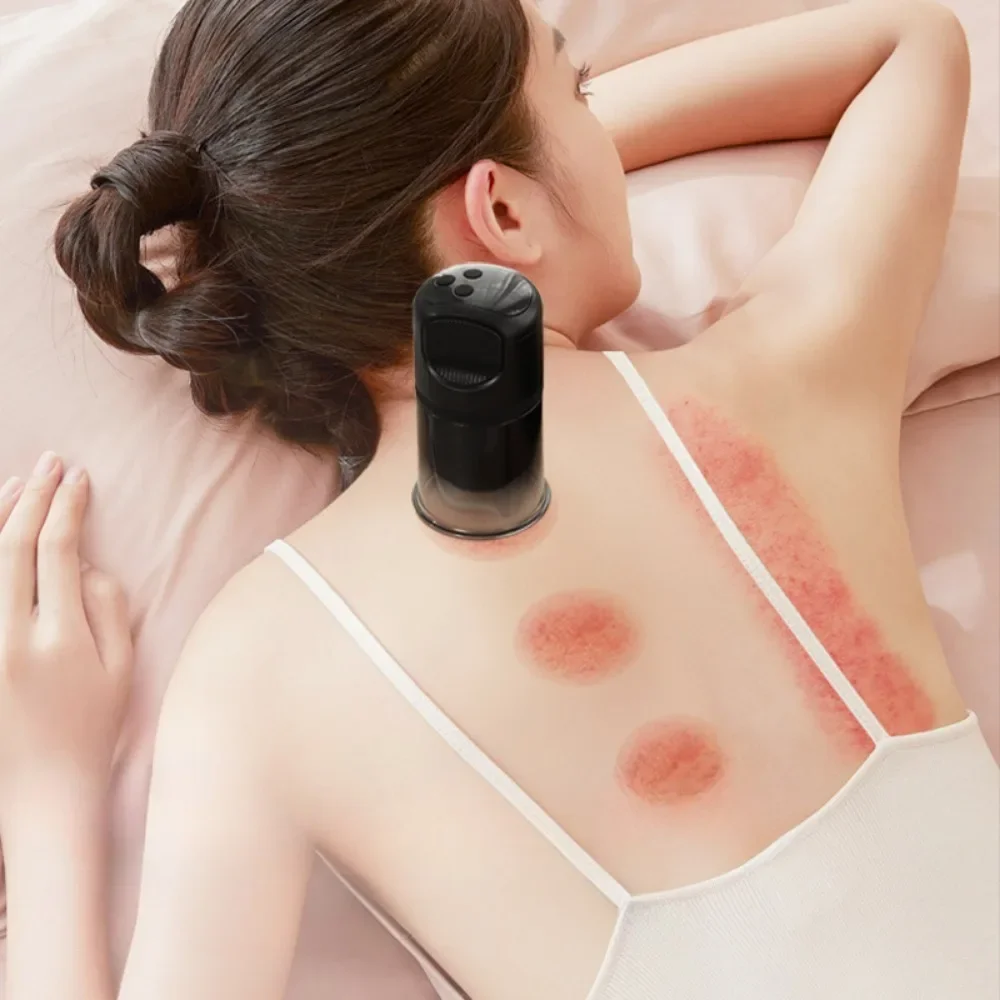 

Electric Cupping Machines General Gas Tank Lymphatic Dredging Meridian Scraping Instruments Electric Scraping Vacuum