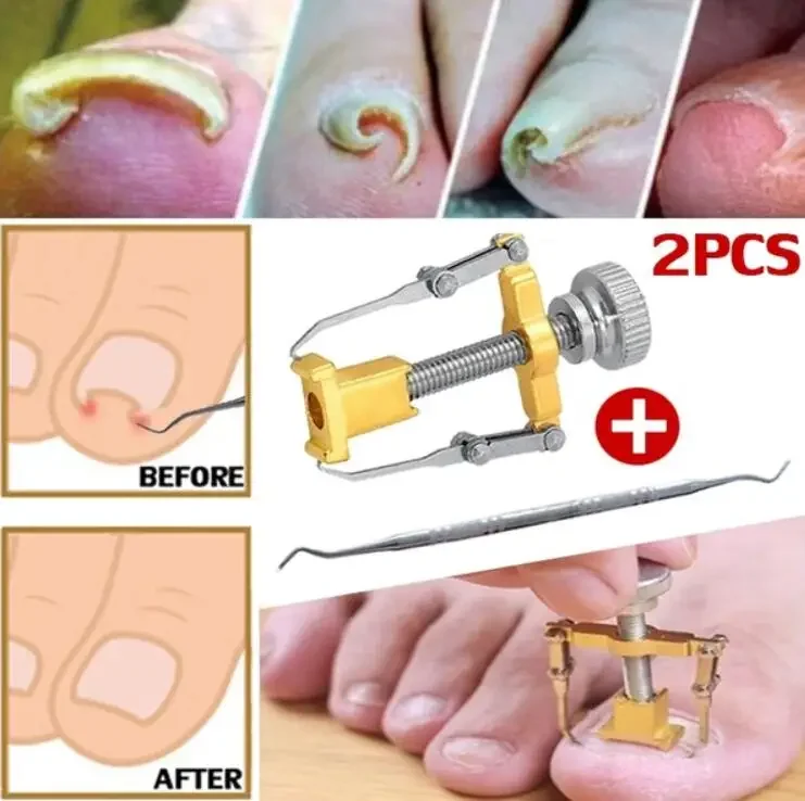 Wrastające paznokcie stóp Pedicure narzędzie do pielęgnacji stóp paznokci korekta Clipper frezy do Orthotic acroonyx martwa skóra Remover Podiatry