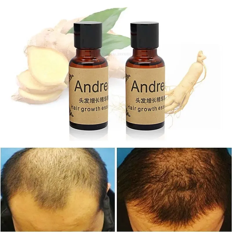 Andrea Growth Anti Hair Loss Liquid 20ml Dense  Fast Sunburst Hair Growth Grow Alopecia Essence Oil  Hot Selling