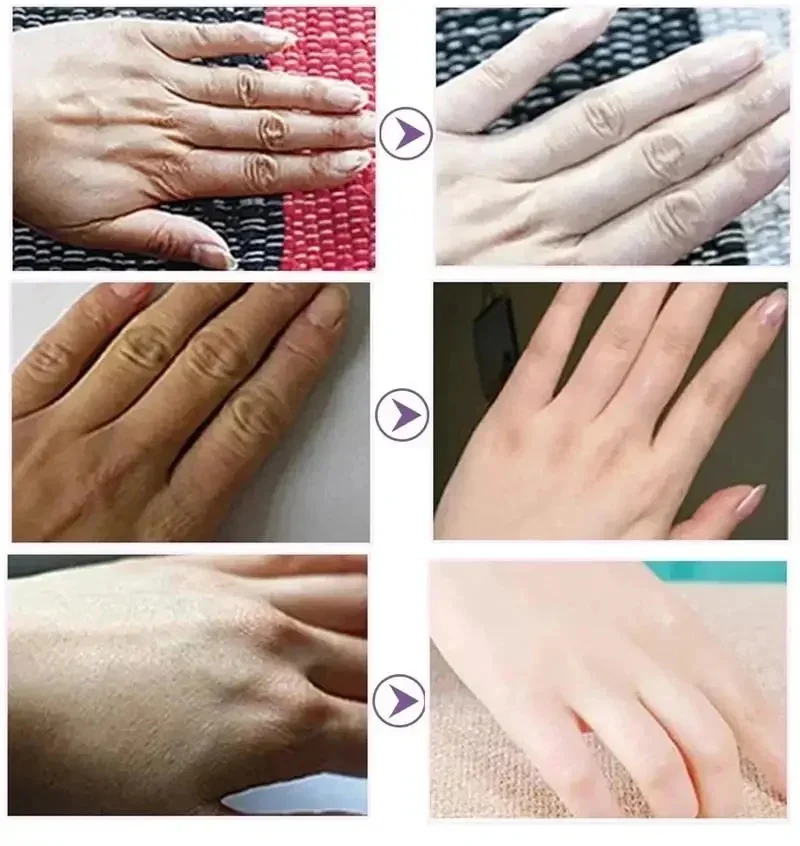 Wrinkle Removal Anti-Crack Hand Cream Skin Cracked Repair Products Soften Nourish Anti-drying Whitening Moisturizing Hand Care