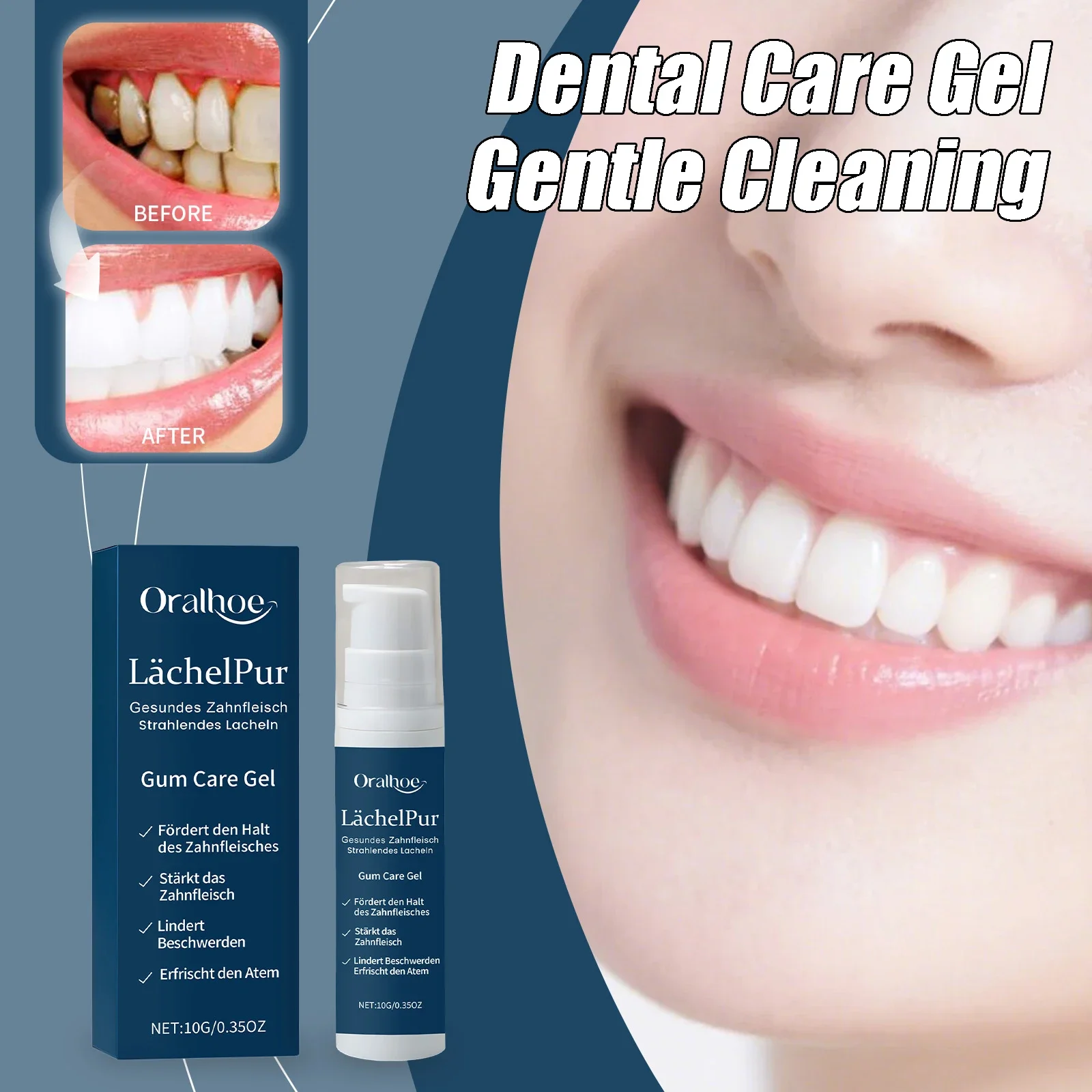 Gel de soin dentaire, nettoyage en douceur, élimine les taches dentaires, apaise les gencives, protège l'émail dentaire, prévient la reculée des gencives, gel de soin des gencives 10g