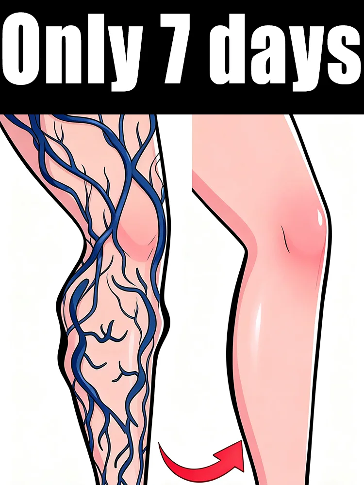 

Wᴇᴀʀ Sʜᴏʀᴛs Wɪᴛʜ Cᴏɴғɪᴅᴇɴᴄᴇ: Vᴀʀɪᴄᴏsᴇ Cʀᴇᴀᴍ Tʜᴀᴛ Sᴜᴘᴘᴏʀᴛs Yᴏᴜʀ Vᴇɪɴs