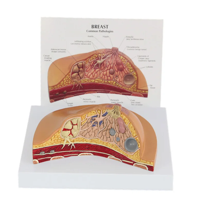 

Human Female Breast Common Pathology Anatomy Model lesion model