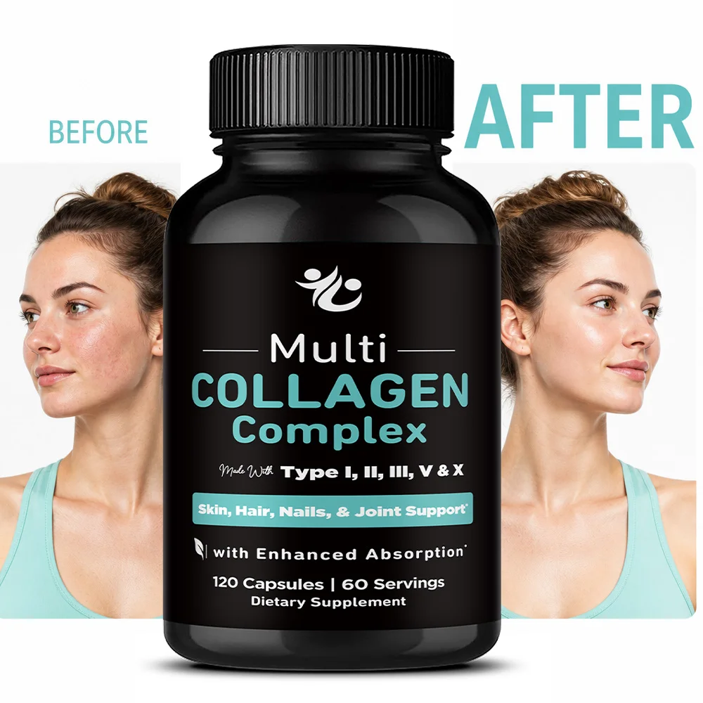Collagen Peptides - Supports Overall Health, Improves Gut and Digestive Function, Enhances Absorption, Boosts Immunity, Non-GMO