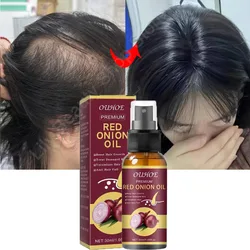 Spray poderoso para crescimento capilar, produtos soro anti-perda de cabelo, reparação rápida, nutre o recrescimento das raízes, engrossar cuidados com os cabelos para homens e mulheres