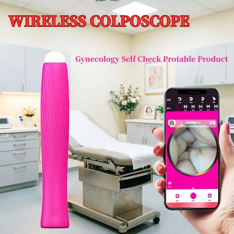 Female cervical and vaginal wall observation care endoscope camera, Endoscope Gynecology Self-exam Detection care tools, clinic