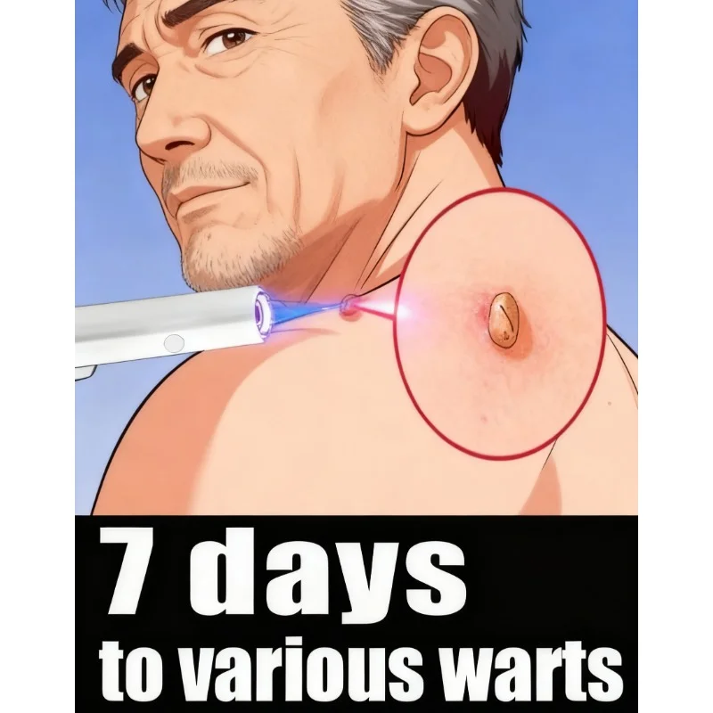 

2nd ᵍᵉⁿᵉʳᵃᵗⁱᵒⁿ ᵘᵖᵍʳᵃᵈᵉᵈ wᵃʳᵗ ⸴ ᑫᵘⁱᶜᵏˡʸ， ʳᵉpᵃⁱʳ wᵃʳᵗˢ ʳᵒoᵗ hot 88