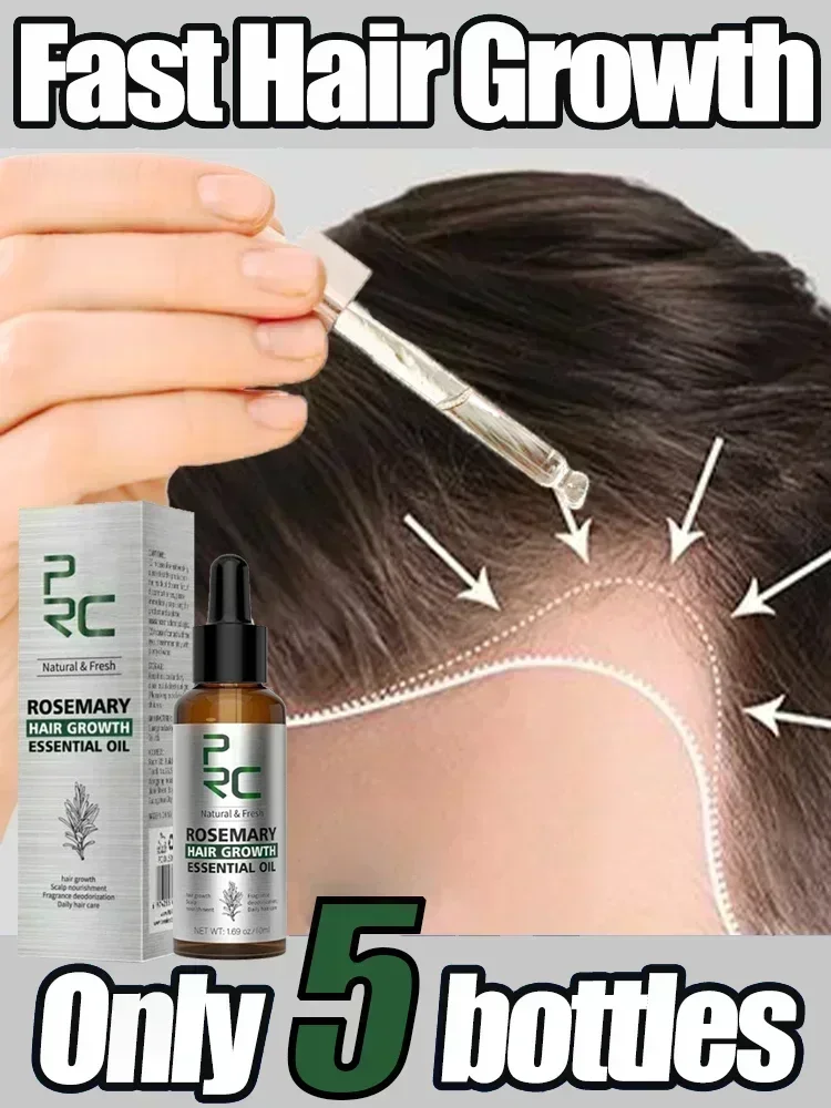 Nourishing Hair Essential Oil, Reducing Hair Loss, Hair and Scalp Repair Care ScalpHair Repair Serum Rejuvenates and Reduceshair