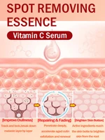 Éclairer les taches de rousseur Melasma, les taches foncées du visage 4