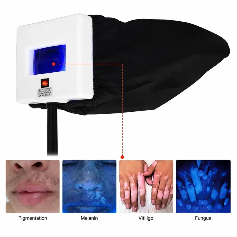 UV Analyzer Wood Lamp Facial Skin Tester Magnifying Appraisal Greyness Tinea Machine Beauty SPA Salon Equipment