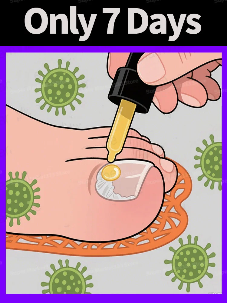 

Toenail Fungus Tools Cleaning Nail Repair Pedicure Manicureed Gray Package Tools in 7 Dyas