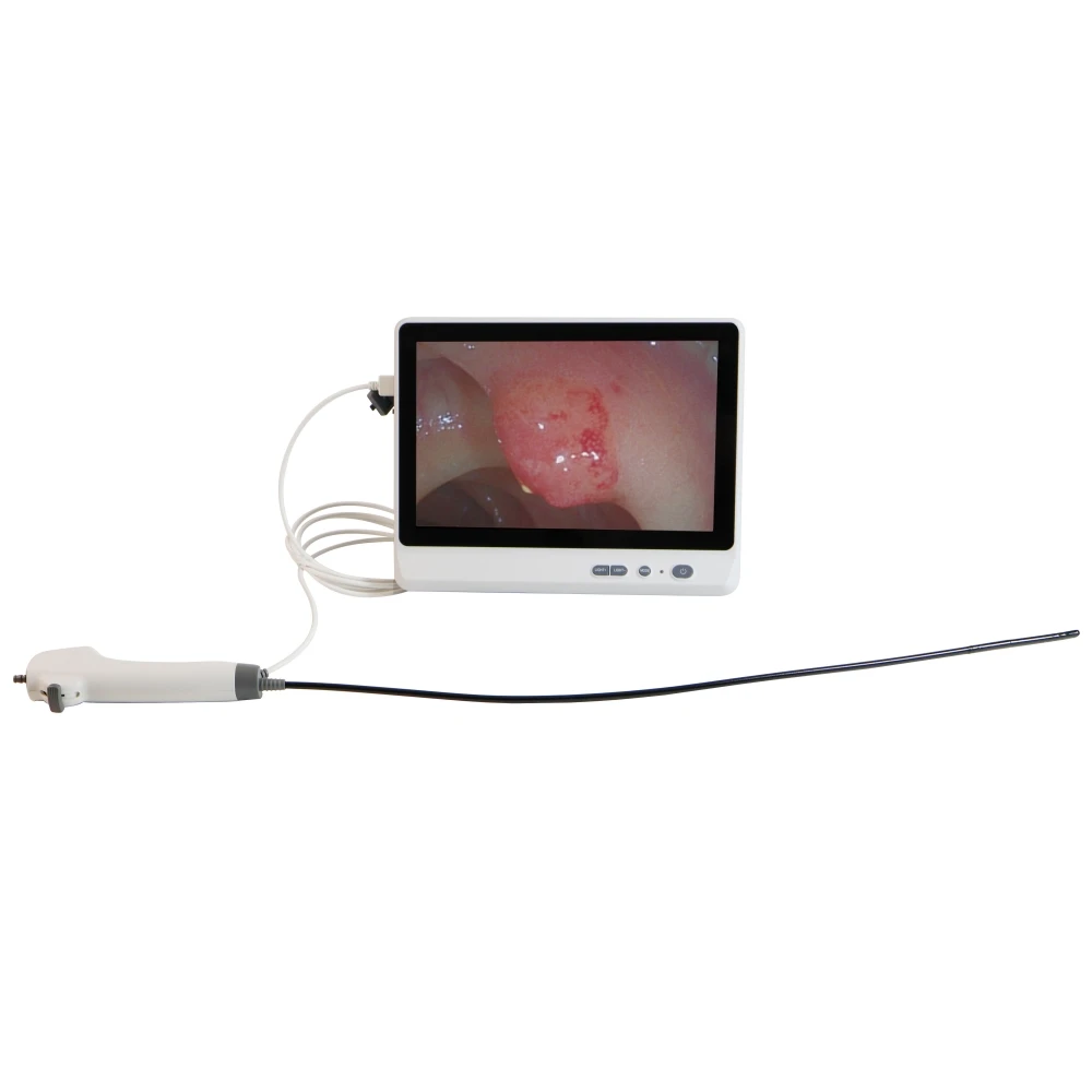Camjoy Best Selling 2.8 3.8 4.8 5.2 5.8 mm Disposable Portable Flexible Bronchoscope