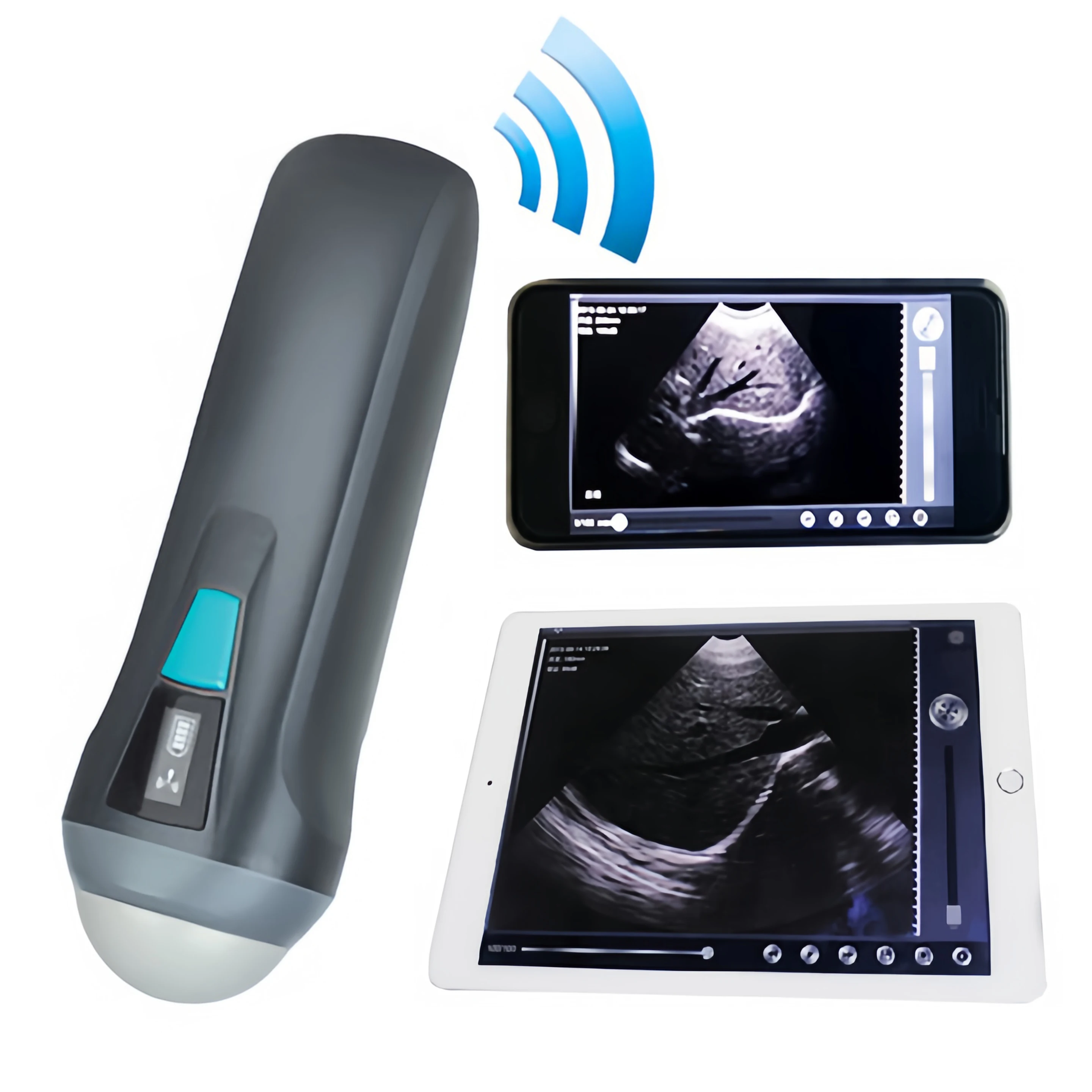 Medical Instruments Portable Mechanical Sector Sweep USB WIFI MacOSx B Mode Adjustable Wireless Ultrasound Probe Sonicator
