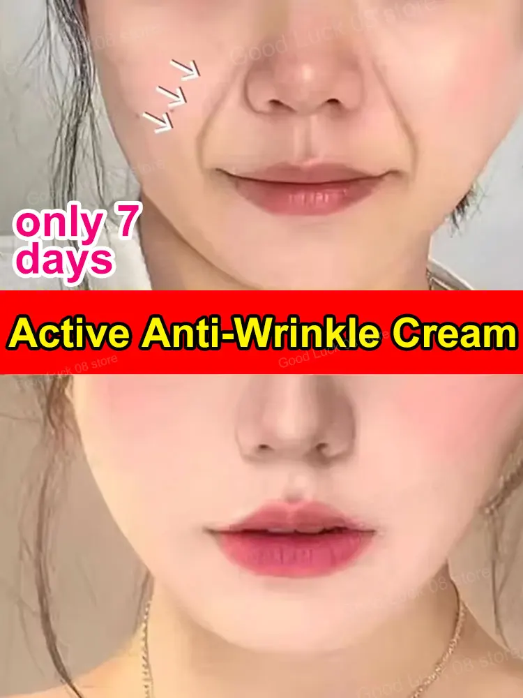 

for wrinkles, 20 years younger