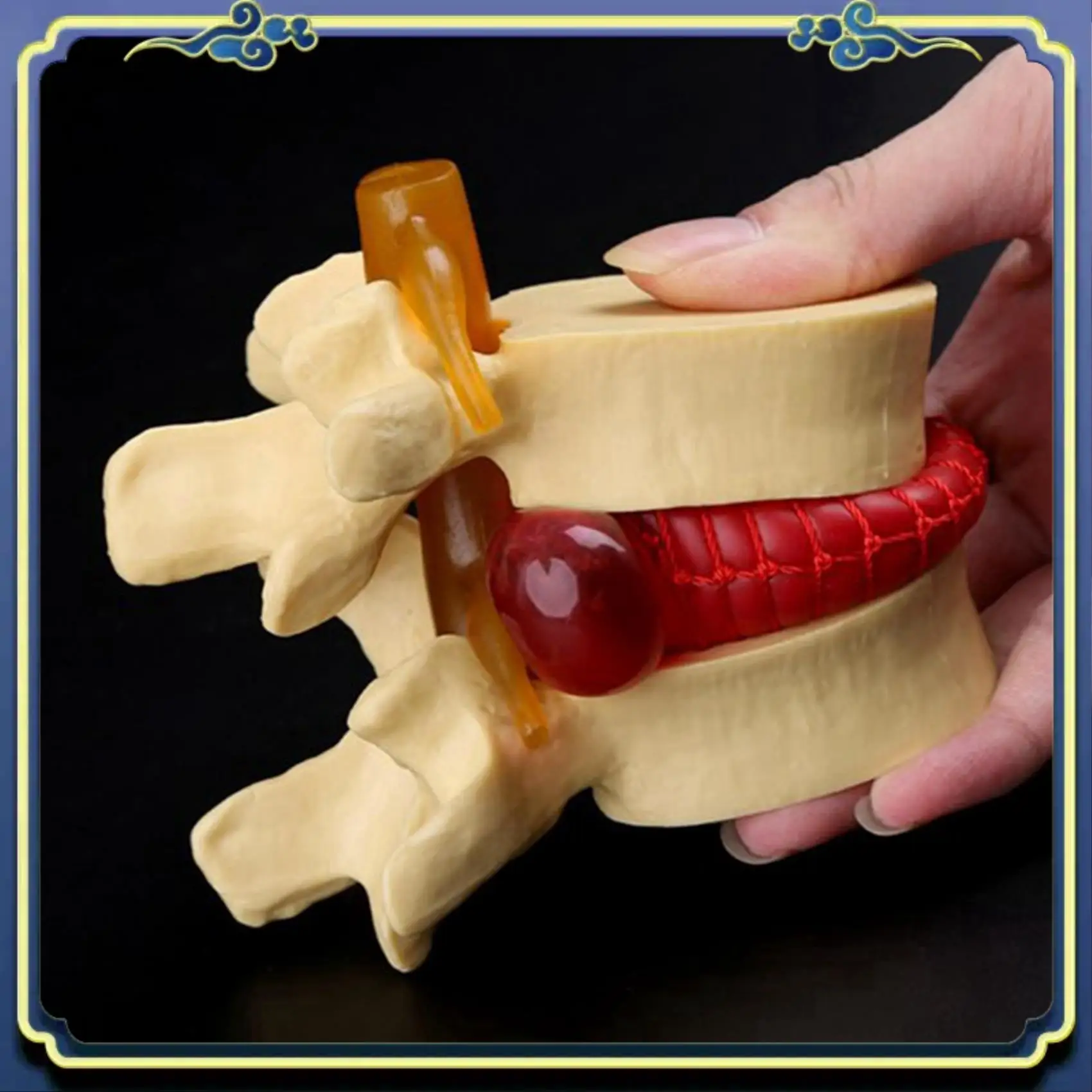 Portable 2X Lumbar Vertebrae Model Anatomical Spine Lumbar Disc Herniation Anatomy Teaching Tool Lumbar Vertebrae Model