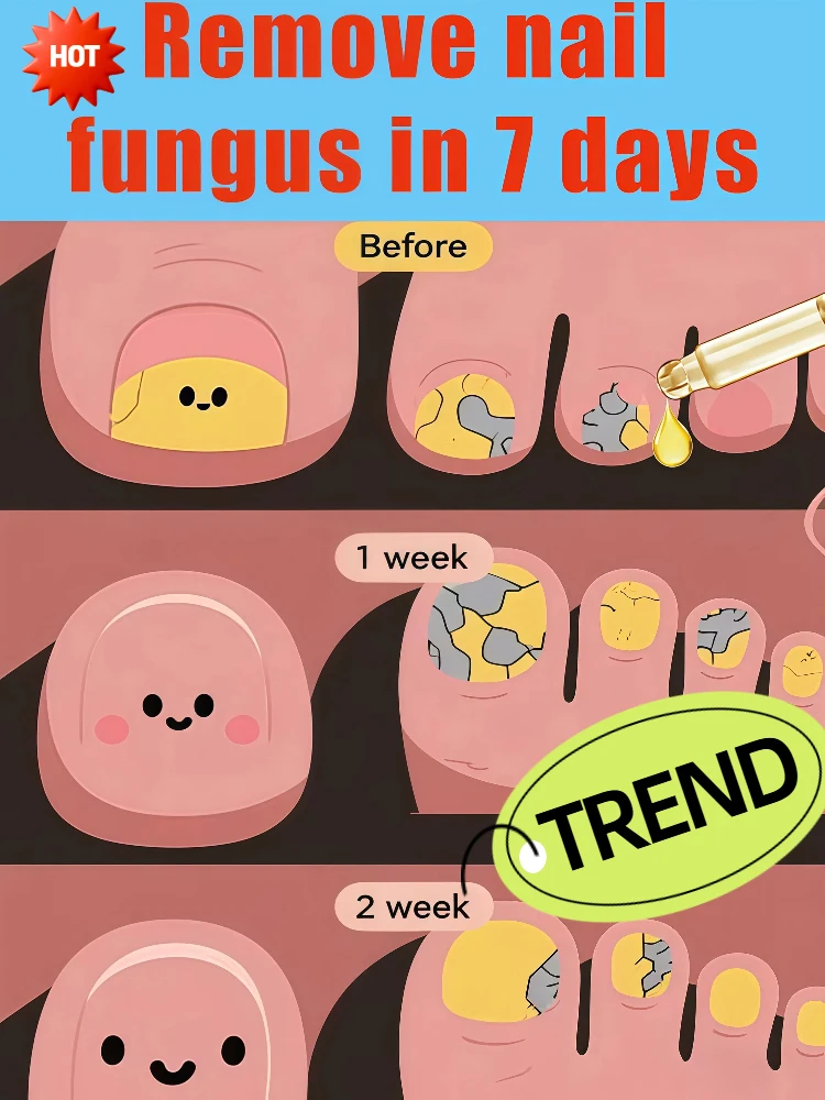 

Скажи прощайте, нет рекурса, не повреждает ногти.