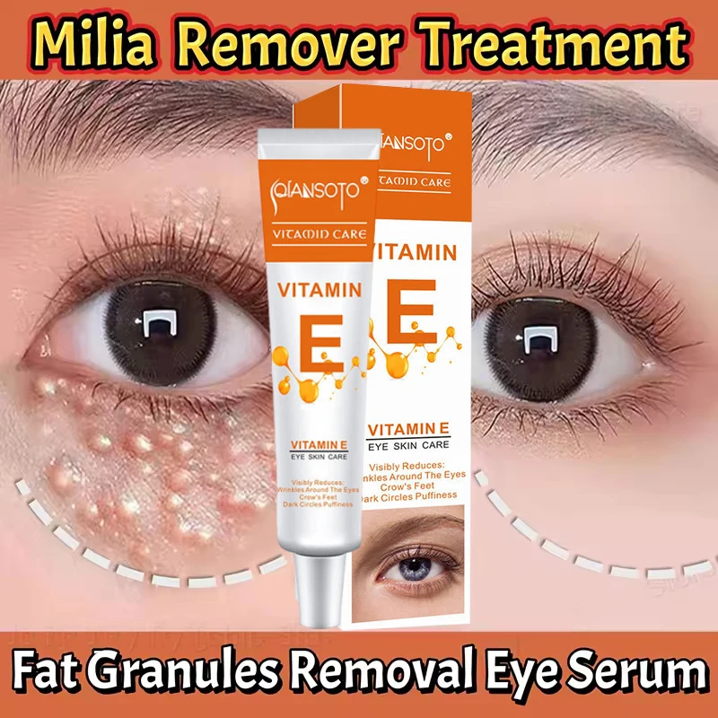 

Eye Fat Granules Removal Cream Anti-Puffiness Firming Product Anti Inflammatory Fade Fine Line Repair Skin Barrier Skin Care