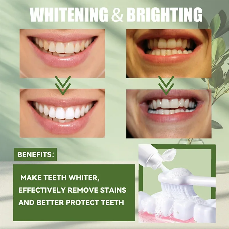 Professional Strength Probiotics Whitening Toothpaste for Intensive Stain Removal and LongLasting Fresh BreathOral Care