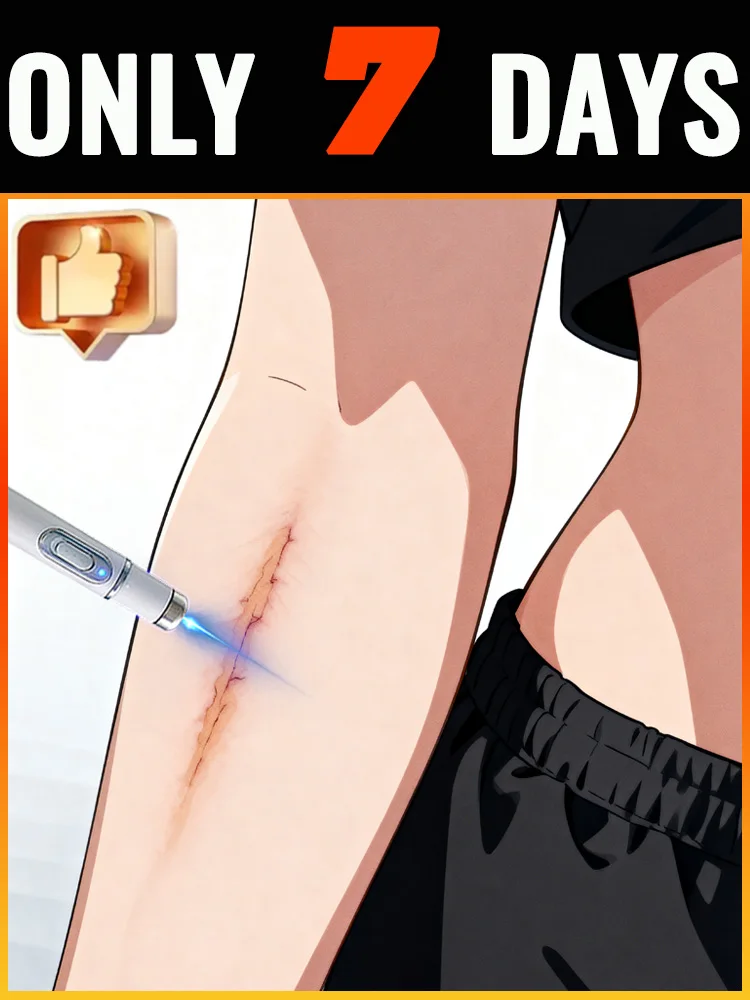 흉터 제거 및 치유를 위한 첫 번째 세대 업그레이드 제품